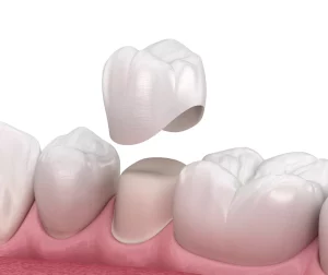 dental crowns in chelsea Dr. Jeya Guna Dr. Luxmi Guna Dr. Aynka Guna Dr. Anuradha Deshmukh Dr. Oleg (Alex) Agranovich Dr. Angela Lin Dr. Jubin Zaboulian Dr. Rekha Hariwala. Dental Health Internationa. General, Cosmetic, Restorative, Preventative, Family Dentistry Dentist in Chelsea, MA 02150