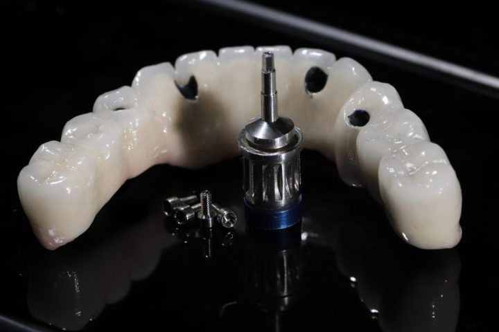 The,All-on-4,,All-on-x,,And,All-on-4,Treatment,Concepts,In,Dental,Implant all-on-x dental implants boston