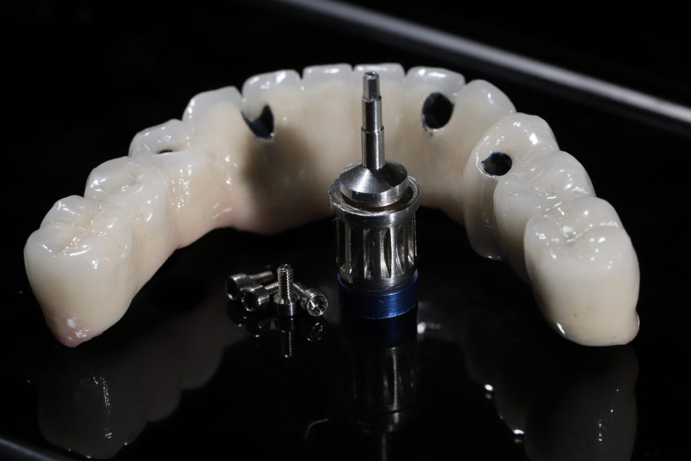 The,All-on-4,,All-on-x,,And,All-on-4,Treatment,Concepts,In,Dental,Implant all-on-x dental implants boston